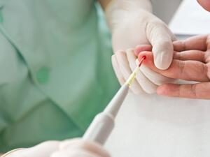 A new device is capable of screening blood that captures 3.5 times the number of cancer cells as the current method. (Shutterstock)