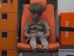 The now famous image of Omran Daqneesh in Aleppo (Aleppo Media Center)