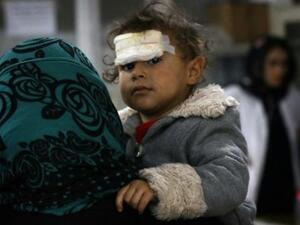 طفل اصيب في المعارك بين القوات العراقية والجهاديين في الموصل

