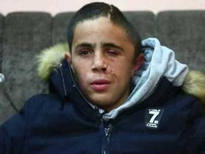 محمد التميمي