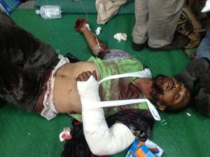 سقوط 40 قتيلا وأكثر من 500 مصاب إثر إطلاق قوات الجيش والشرطة الرصاص الحي على المعتصمين المؤيدين لمرسي