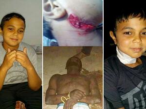 انتشار مخدر “الفلاكا” المعروف بـ”الزومبى” فى مصر