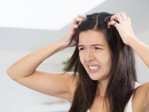 عصير الليمون وتأثيره السحري على قشرة الرأس