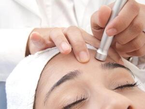 التقشير بالالماس