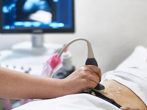 متلازمة التوأم المتلاشي حالة طبية نادرة
