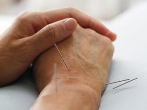 الوخز بالإبر والتأمل والعلاجات بالأعشاب يساعد في التخفيف من أعراض الصدفية