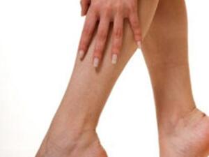 3 علاجات طبيعية لعروق الدوالي أثناء الحمل