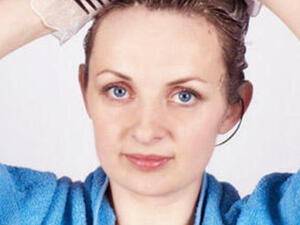 ماذا لو اصيب جلدي بالحساسية من الصبغة