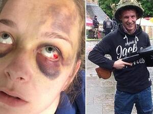 Former soldier headbutted his girlfriend leaving her with horrific face injuries (Twitter)