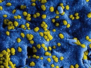 t has been six years this month since the first outbreak of Middle East respiratory syndrome (MERS) was reported in Saudi (Twitter)