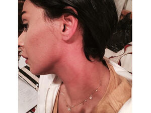 Mais Hamdan shows off her red neck after a hard day of filming. (Image: Facebook)