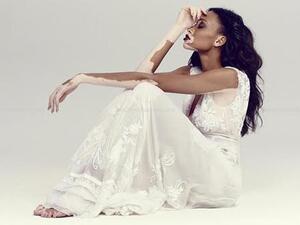 عارضة الأزياء التي تحدت مرض" البهاق"