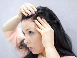 يعمل زيت شجرة الشاي على تقليل إفراز الزيوت الزائدة في فروة الرأس

