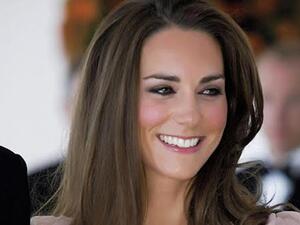 تتمتع كيت ببشرة نقية وجميلة على الرغم من تعرض بشرتها للعوامل المؤذية

