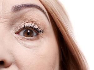 طبقي 3 نقاط من زيت الزيتون على محيط ما تحت العين