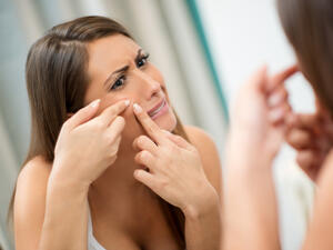 حب الشباب يزعج المرأة وأحياناً يصيبها بالإحباط والإحراج

