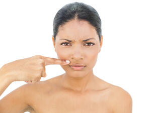 إزالة الشعر فوق الشفة