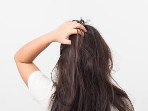 يحتوي البيض على الفيتامينات التي تلعب دورًا هامًا في تقوية الشعر 