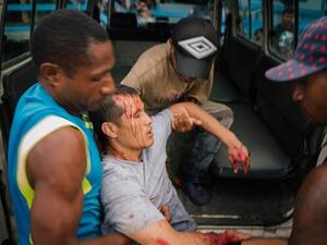 This image, taken on August 10, 2016, shows a refugee injured during protests at an Australian detention facility on Manus Island. (AFP/File)