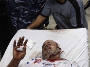 نقل فلسطيني جريح الى مستشفى الاقصى 