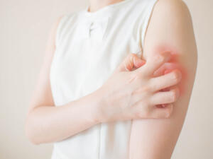 من أسباب الطفح الجلدي التعرّض لمستحضرات التجميل الخاصّة بالأطفال
