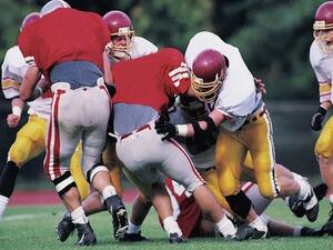 The study was published recently in the journal Neuroimage: Clinical. (Photo: healthday.com)