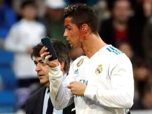 رونالدو يتفقد إصابته في وجه باستخدام هاتف محمول