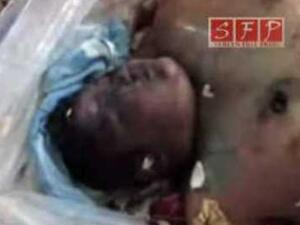 Syrian victim