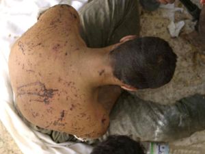 صورة يجري تداولها عبر الانترنت لمواطن يدعي تعرضه للتعذيب/ارشيف