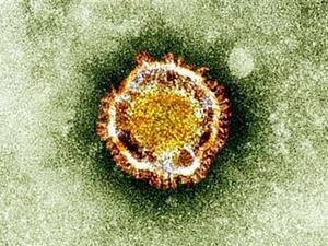 Coronavirus seen under an electron miscroscope (British Health Protection Agency/ AFP)