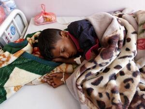 A Yemeni boy receives treatment at a hospital in the capital Sanaa on 11 October 2016 (AFP)