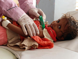 A Yemeni child suspected of being infected with cholera is checked by a doctor at a makeshift hospital. (AFP) 