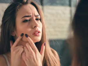 حب الشباب من أكثر المشاكل التي تسبّب الإحراج للعديد من الأشخاص

