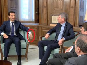 يد الأسد اليسرى أثارت جدلا واسعا حول احتمالية إصابته بجلطة