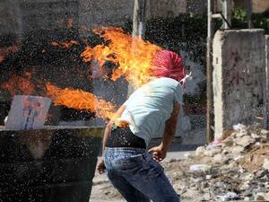 أحد المصابين الفلسطينيين في حالة خطرة