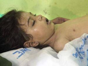  الحكومة السورية استخدمت غاز السارين وهو من غازات الأعصاب