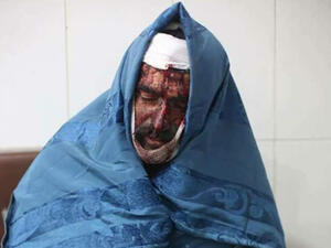 سويسرا صدّرت 5 أطنان من مادة كيميائية محظورة إلى سوريا
