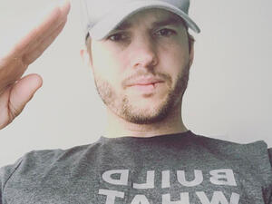 The teenager suffered a grazed knee (Source: aplusk / Instagram )