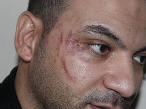 العامل المصري المعتدى عليه