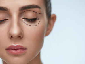  مشكلة الهالات السوداء قد تكون مرضية