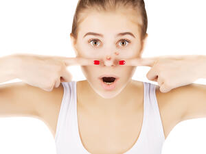 الرؤوس السوداء من المشاكل التي يُعاني منها معظم الرجال والسيدات خاصة

