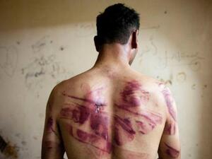 A Syrian man shows marks of torture on his back, after he was released from regime forces, in the Bustan Pasha neighborhood of Syria's northern city of Aleppo on August 23, 2012 (AFP/James Lawler Duggan)