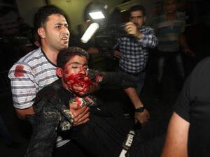 جريح في مستشفى الشفاء بمدينة غزة/أ.ف.ب