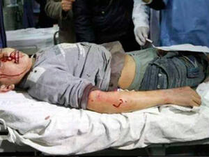  شهيدان بينهم طفلة وحماس تخلي مقراتها