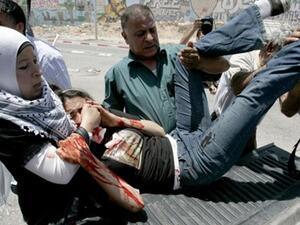 ناشطة سلام اميركية اصيب بعينها خلال تظاهرة اليوم في مخيم قلنديا في الضفة الغربية احتجاجا على الهجوم الاسرائيلي/أ.ف.ب