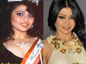So she DID have plastic surgery after all. (Plastic Surgery Hits)
