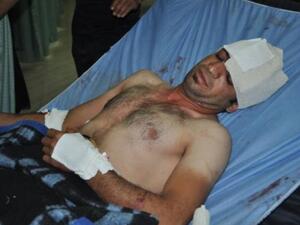 Iraqi wounded