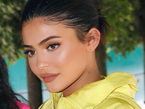 Kylie Jenner reveals she has had all of her lip filler removed (Source: kyliejenner / Instagram)