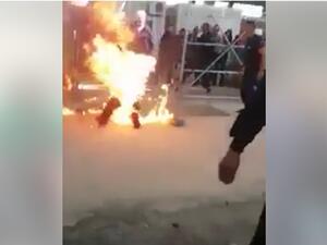 يعاني الشاب من حالة سيئة حرجة للغاية بسبب الحروق الشديدة التي تعرض لها