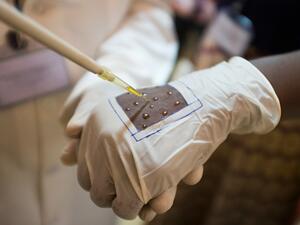 مصر تشهد أول حالة وفاة بـ"الملاريا" منذ سنوات